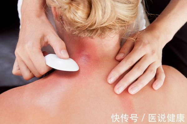 祛湿|湿气重易生病,要及时调理,这5个方法有效祛湿,不妨试试