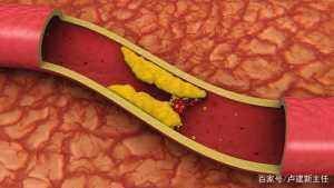 粗粮|这一种粗粮是公认的“降脂冠军”,血脂高的人经常吃,血管通透