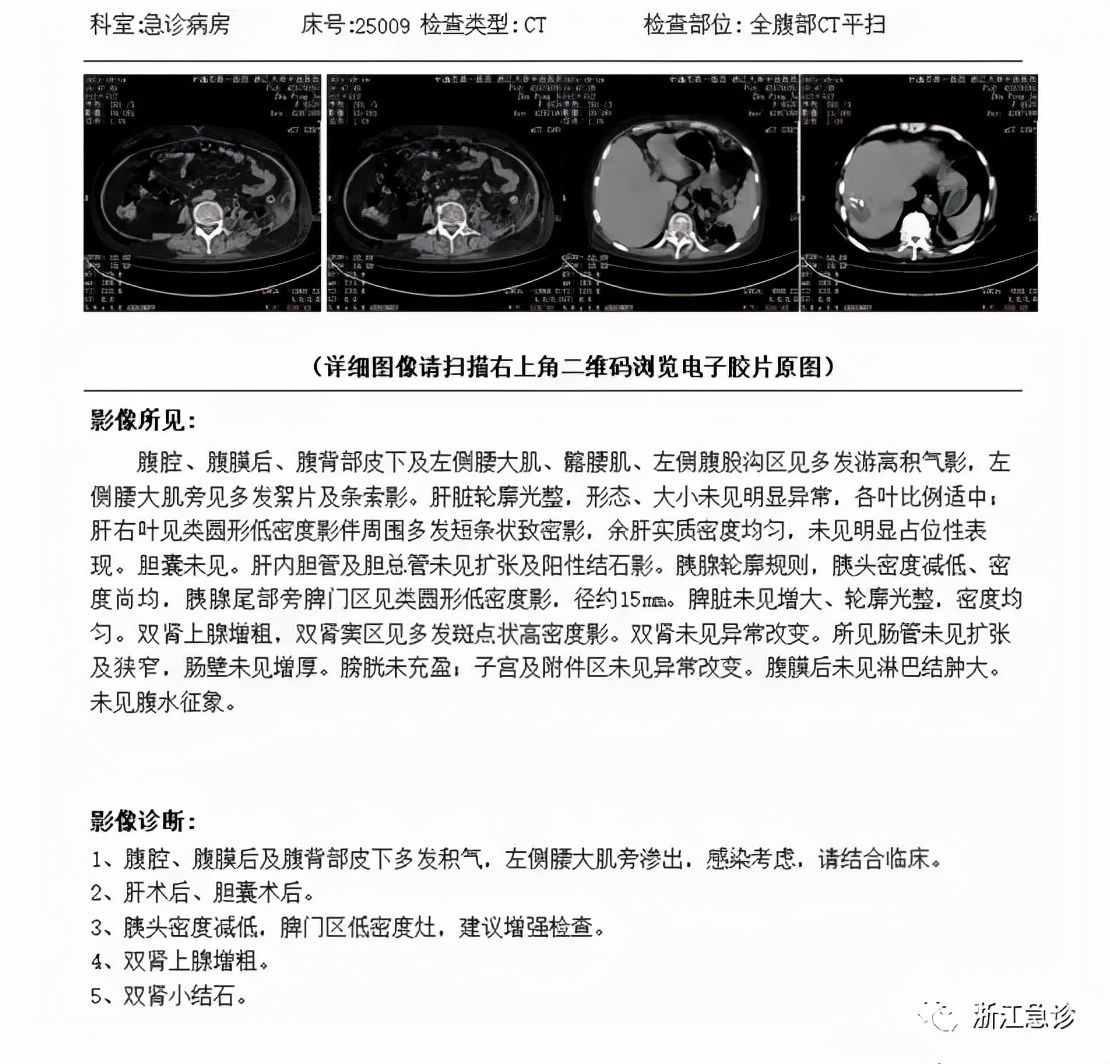 红肿|小小皮肤红肿，也可能是致命的疾病！这一类皮下感染不要疏忽