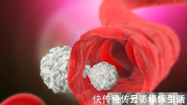 清理血管|高血脂的“劲敌”被找到,并非山楂,若你爱吃,血脂或乖乖降下来