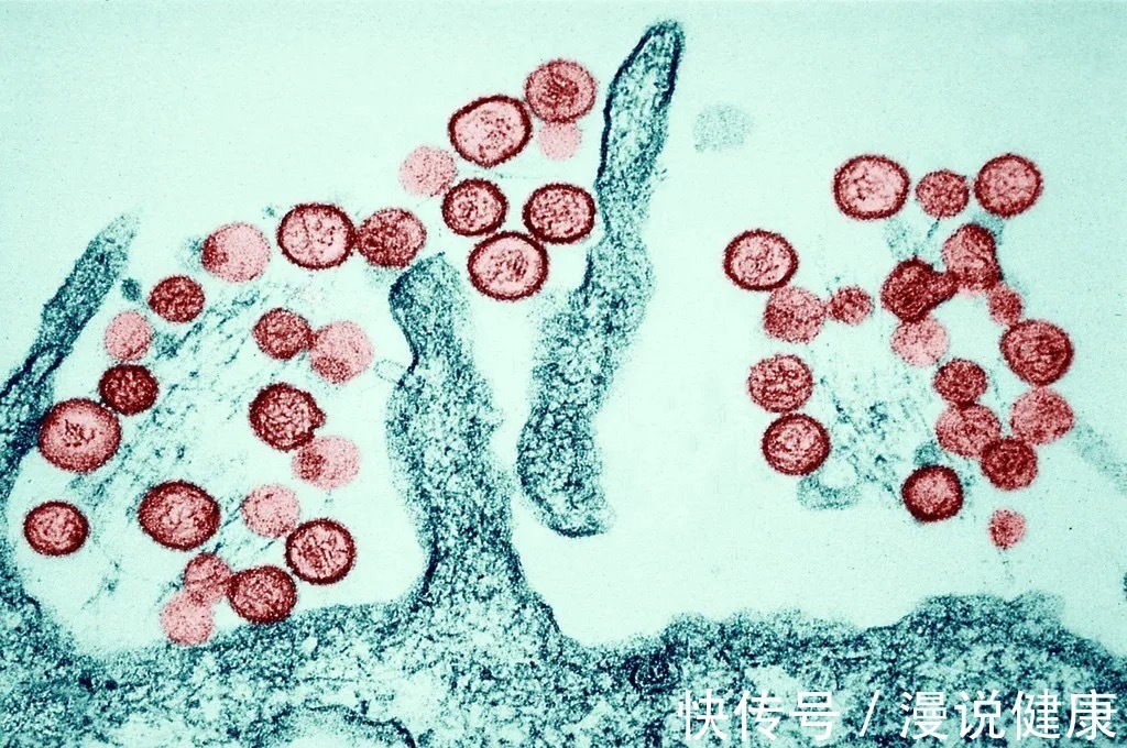 病死率|西安出现多例出血热患者:出血热,到底是什么?致死率又有多高?