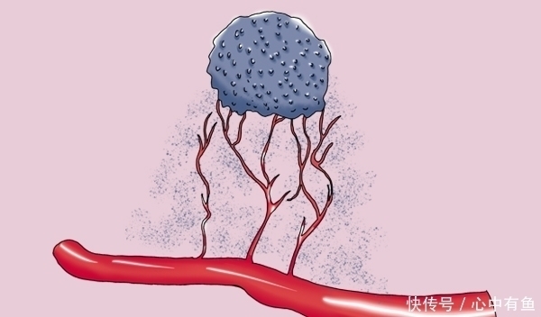 答案|肺癌晚期，吃靶向药时，会不会出现不耐药？医生给出明确答案