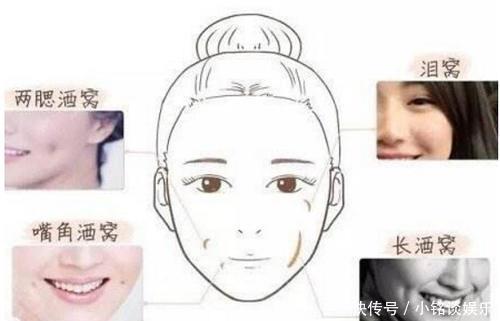 真的|整容界又现“黑科技”,酒窝也有人工的,网友:全身还有真的吗?