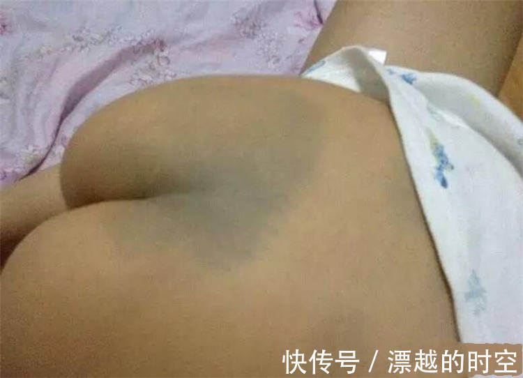 阎王爷|胎记是怎么来的,有人说是被阎王爷打答案可能不是你所想的