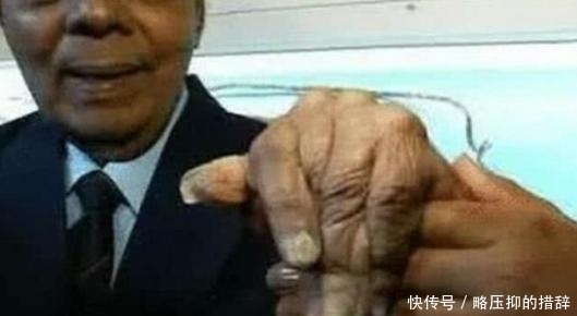 印度一男子锯掉了留了66年的指甲,左手已“废”?网友:确实不值得