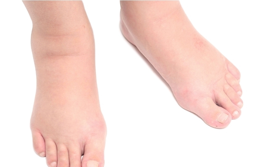 器官|早上起床时,身体若有5个“异状”,说明身体器官在“报警”!