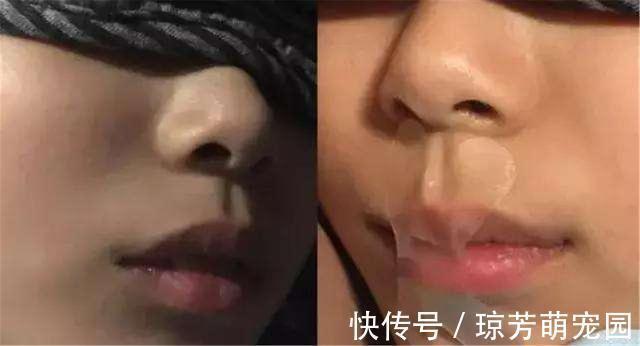 肥胖|女儿爱“张嘴”睡觉,被亲妈用胶布“封嘴”,医生却直夸:做得好