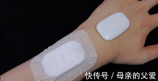 肝脏|肝脏不好的人,身体或有这6个表现,不妨自测一下