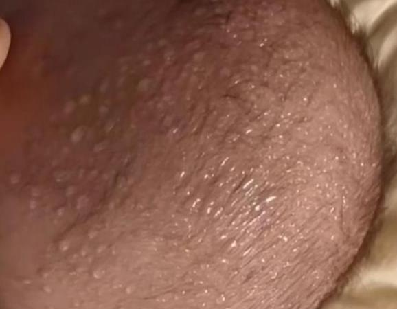 积食|11岁男孩半年长高14cm,儿科主任:3种食物助长高,日常可以多食