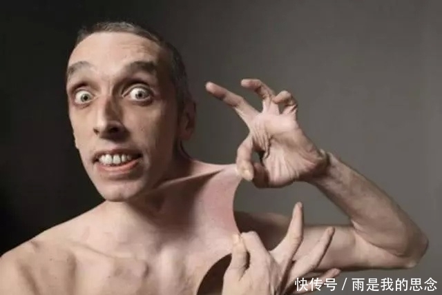 5项最“无聊”的吉尼斯纪录:男子往脑袋上植入天线,有何作用?