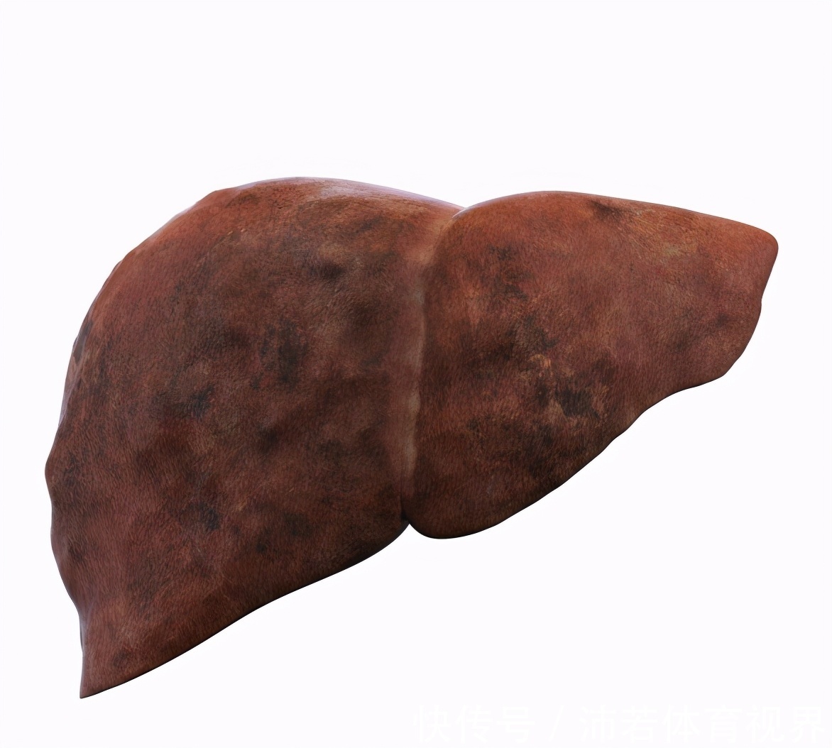 素食|肝不好的人不能吃大蒜?其实,这5种素食才不该吃,望你早做了解