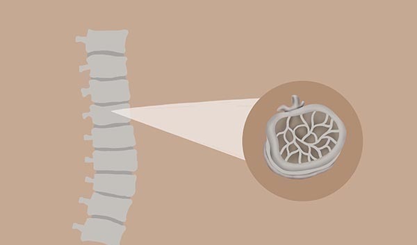 钙质|50岁后,骨质渐渐流失,吃哪些食物能预防疏松?医生列出了清单