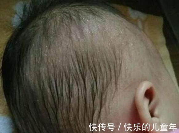 积食|吃一口相当吃7个塑料瓶,还有家长喜爱喂娃吃,医生:愚蠢!