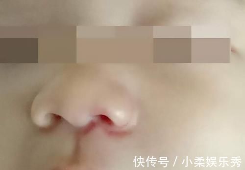 耳垂|宝宝有这5个特征,说明将来很有“福气”,对照看你家娃占几个?