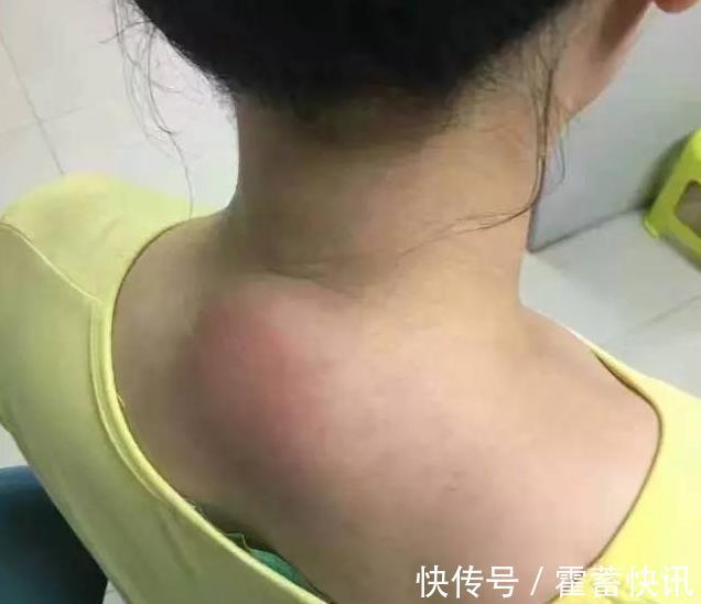 厨房|“十个颈椎九个包”,厨房中拿瓶醋,此法能治好,早知早受益