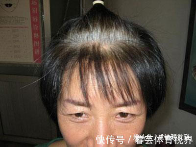 头发|经常染发的老年人,要养成这三个养护好习惯,头皮健康不伤发