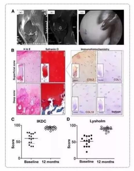 间充质干细胞|中科西部干细胞研究院：干细胞改善关节损伤，缓解膝关节疼痛