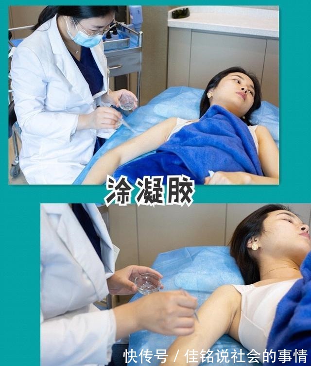 黑金超光子嫩肤 黑金超光子嫩肤真的是无痛的吗!