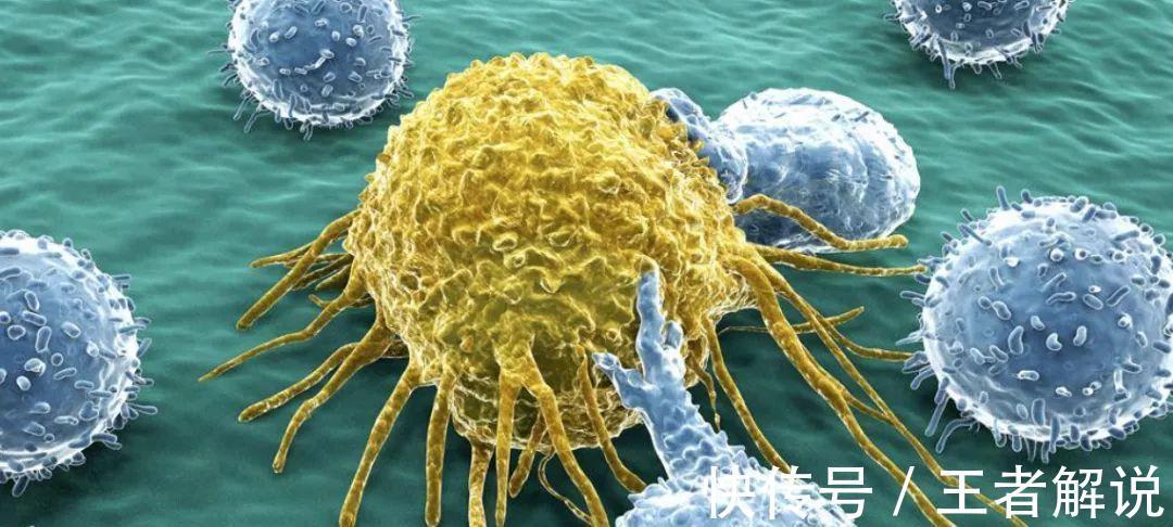 误诊|很会伪装的3大恶性肿瘤，往往发现便是晚期！出现这些症状莫大意