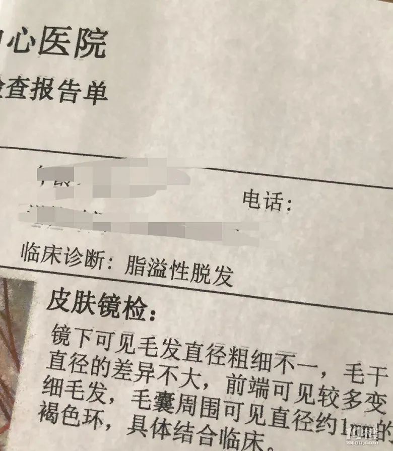 脱发|姑娘崩溃发帖,“我还没生孩子就这样了”!