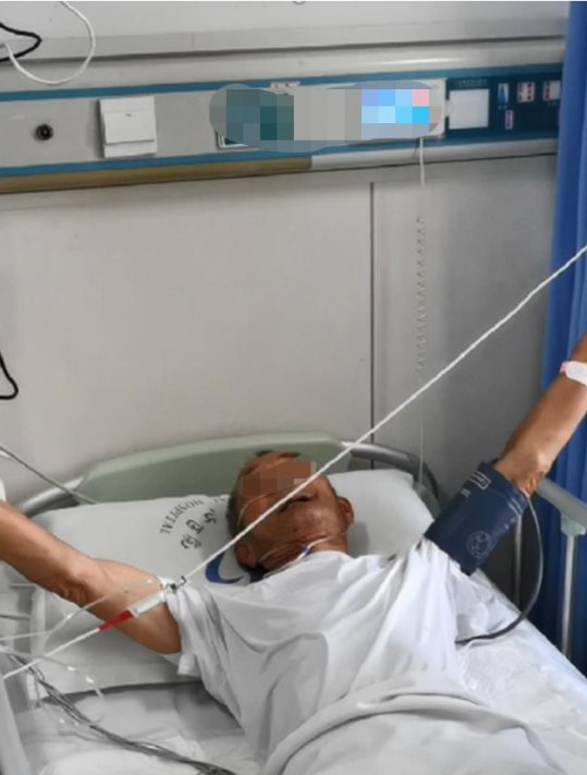 缺血性脑卒中|85岁突发急性脑梗,静脉溶栓联合血管内介入治疗挽救生命