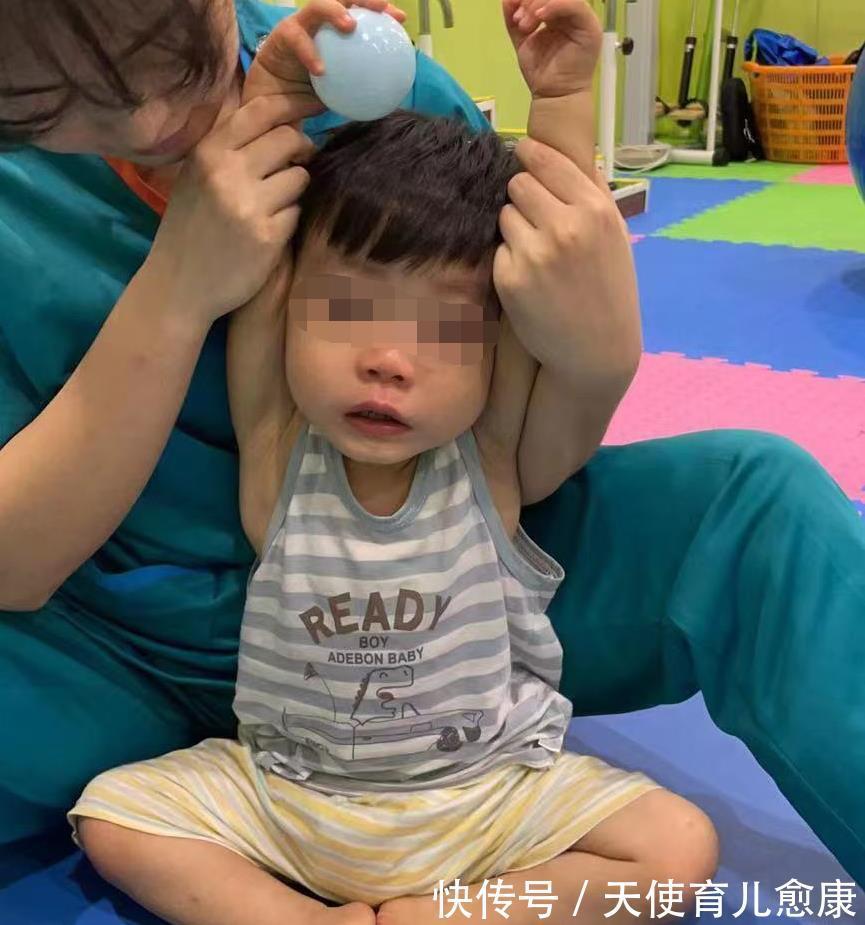 临床表现|天使科普:小儿脑瘫的早期临床表现有哪些?