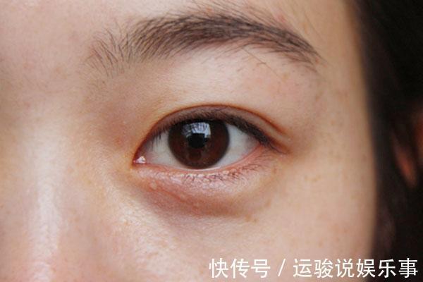 补充|维生素B2不足,损害有多大?几块钱一瓶维生素B2,天天吃会怎样?