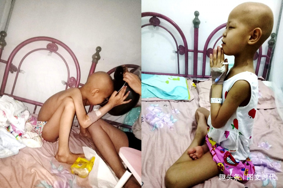 程程|6岁女童鼻子突然红肿,送医查出罕见肿瘤,妈妈含泪打掉腹中胎儿