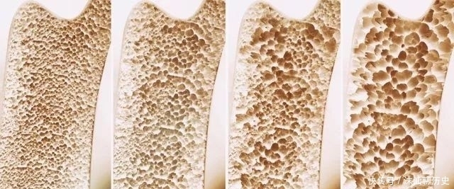 好骨头,吃出来,常吃此方,不再骨质疏松!