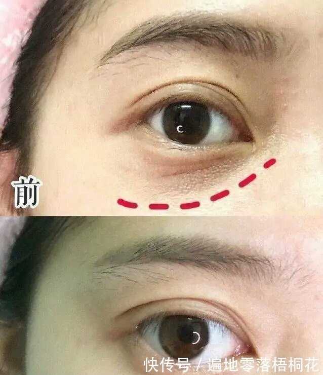 国产品牌 因“价格”被看轻的国货护肤品,能淡化黑眼圈,是精致女人的选择!