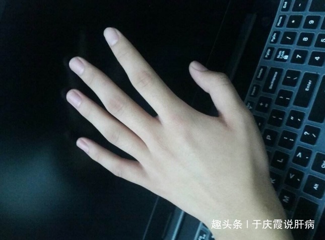 中指|女人肝不好,手上有3点异常,1个也没有,恭喜你