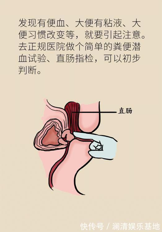 筛查|50岁以后高发的癌症，这5类人提前10年筛查，就能避免太多悲剧