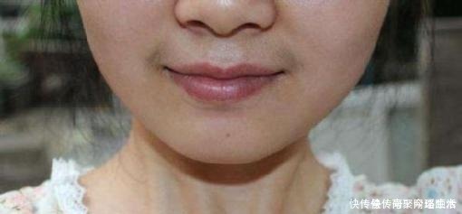 雌激素|为什么有些女生的嘴唇上会长“胡子”?教你两招,轻松去除掉