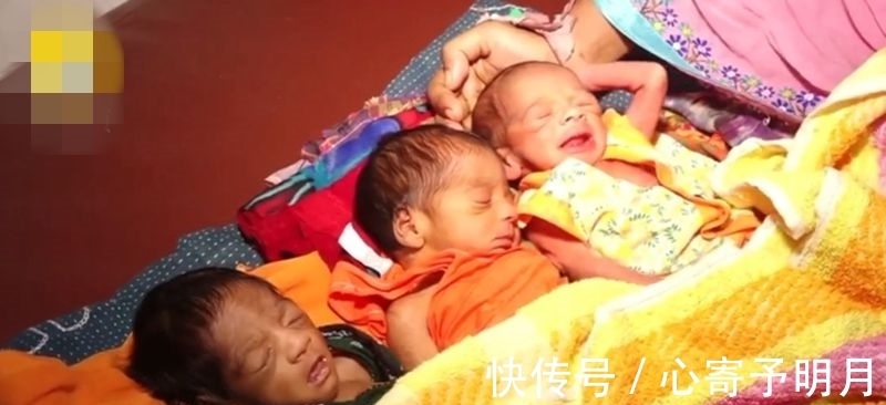 医生|孕妇一个月生3 孩子,竟是双子宫,医生表示也没见过