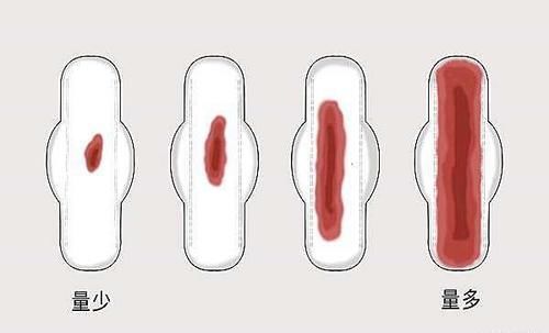 女性|女性荷尔蒙旺盛,与正常人有什么区别提升荷尔蒙,该怎么做