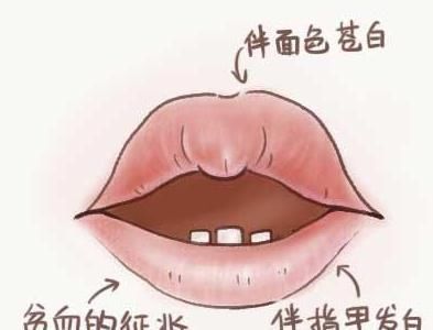  唇红|唇白是气血虚；唇黄是脾胃弱；唇红是火气旺！从“唇色”看健康！