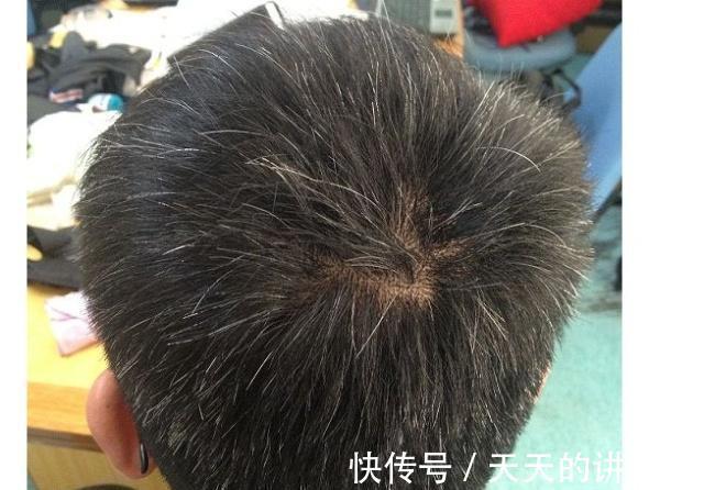 健康状况|寿命短,身体6处可能会发白,若一个不占,提前恭喜,长寿健康