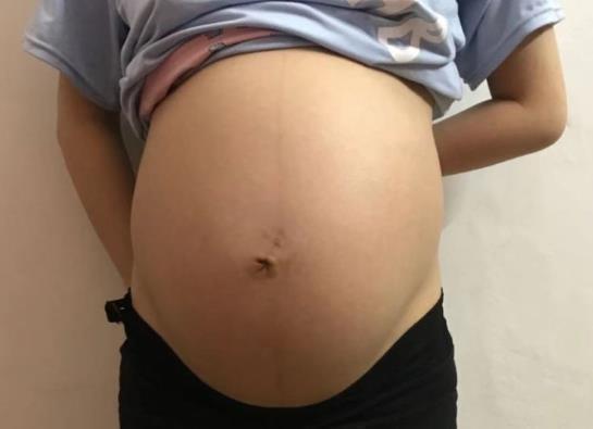 早孕期|过了早孕也不能放松警惕,这一阶段也有胎停,别不当回事