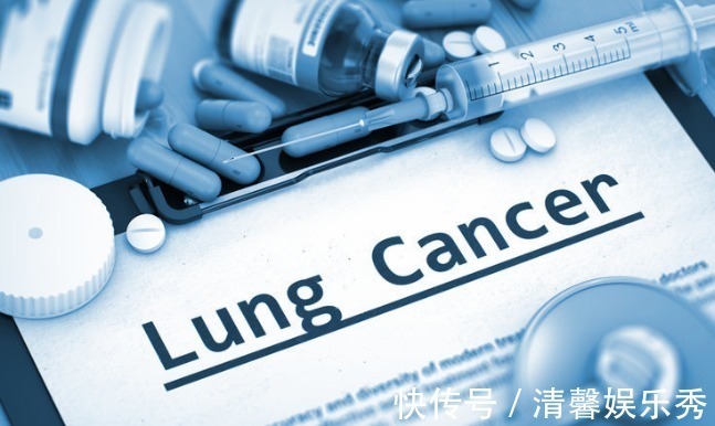 癌细胞|哪些人最容易得癌症？看完这份“名单”吓一跳！看看是否有你