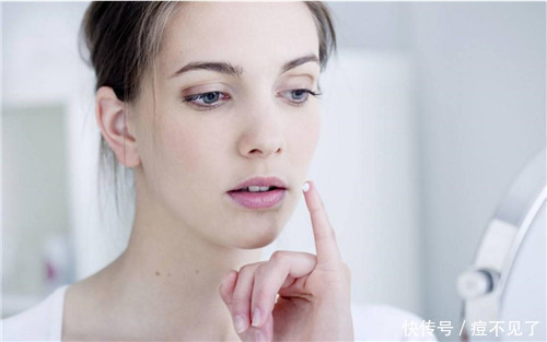 长满青春痘的脸蛋怎么办,痘博士说几点!