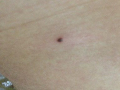 高跟鞋|脚上若没有3个“标记”的人,说明你没被“癌细胞”盯上,恭喜你