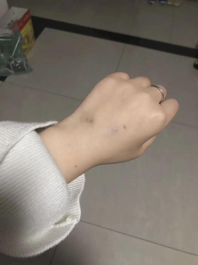 孩子|妈妈拼了!给孩子打生长激素、脊椎埋线花了18万,回头一看全是坑