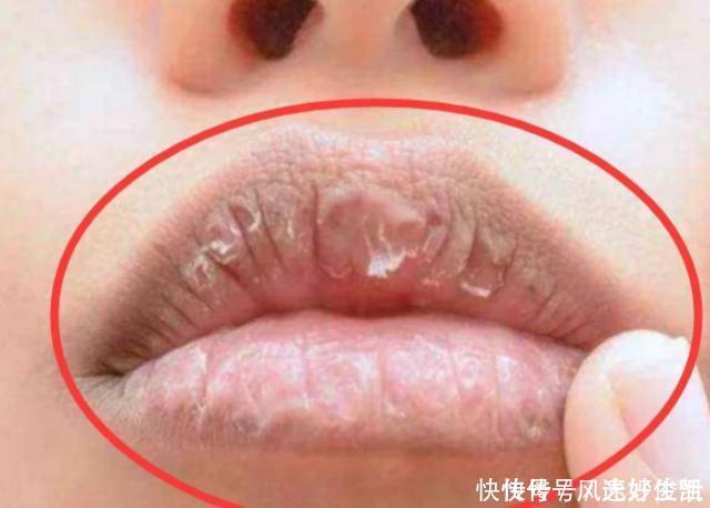 女孩想拥有“樱桃嘴”这3习惯需要改,不然迟早变“香肠嘴”