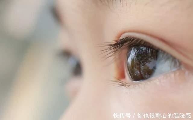 电子产品|越来越多孩子黑眼珠“消失”,与这种“玩具”脱不了干系,需警惕