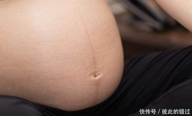小蛮腰|为什么有些孕妈的肚脐是鼓出来的呢可能是这3个原因,快看看吧!