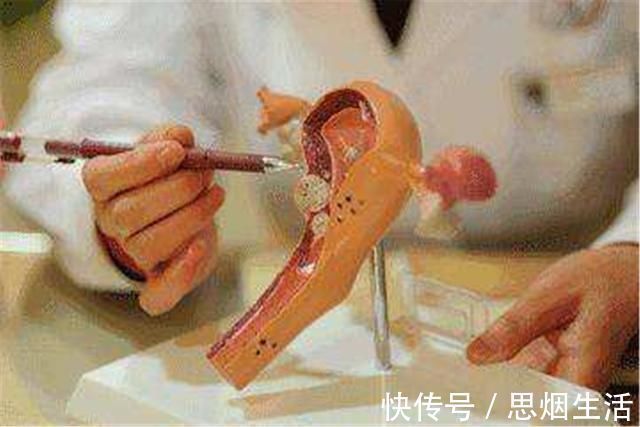 宝妈|坐月子期间不注重这几个细节，子宫容易“掉出来”，6招做好预防