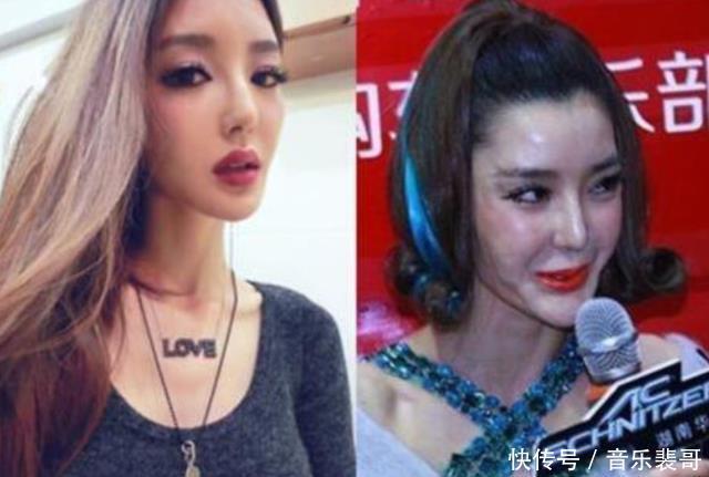 不老女神|还有多少女明星为了变美，而去饮鸩止渴打玻尿酸