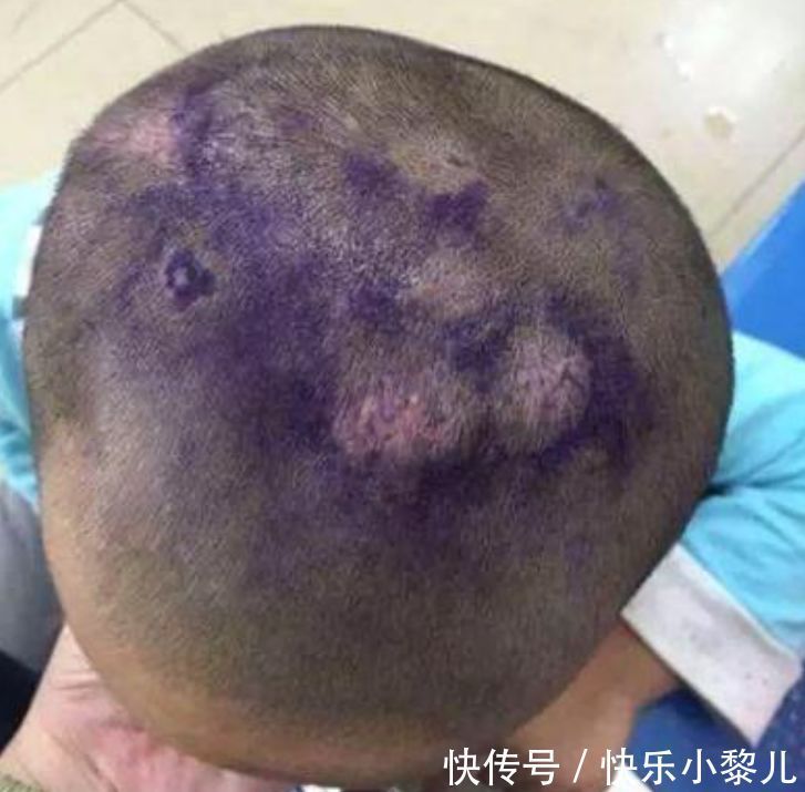 小帅|4岁孙子睡觉总捂着头,奶奶半夜扒开头发,忍不住掉下眼泪