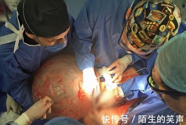 医生|女子未怀孕,肚子却大的出奇,来医院后吓坏医生