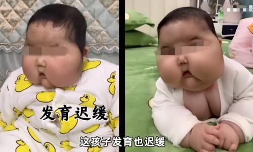 大v|“大头娃娃”再次出现，额头长满汗毛，这次是“毒护肤霜”惹的祸